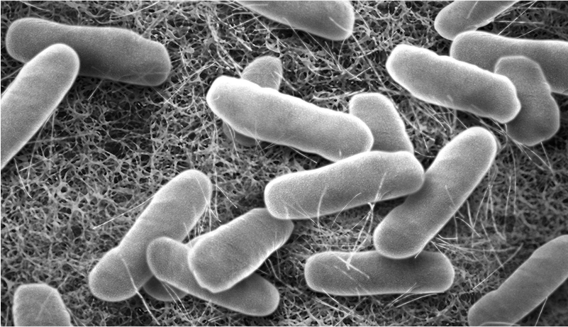 繊維状の構造の上に散在する多数の桿菌の拡大画像